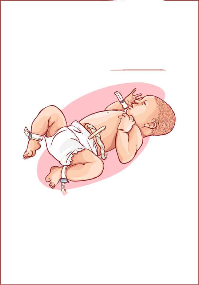 newborn baby umbilical cord care